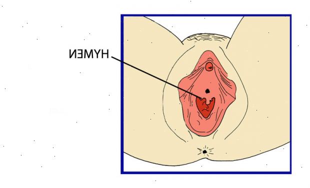 Hymen Probleme. Struktur des Hymen.