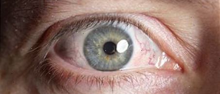 Behandlungen für Augenentzündungen