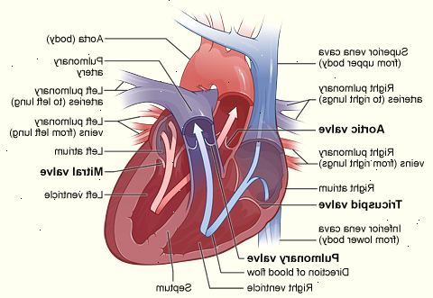 Herzklappenerkrankungen. Was ist Herzklappenerkrankungen?