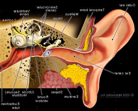 Tinnitus. welche Ursachen Tinnitus?